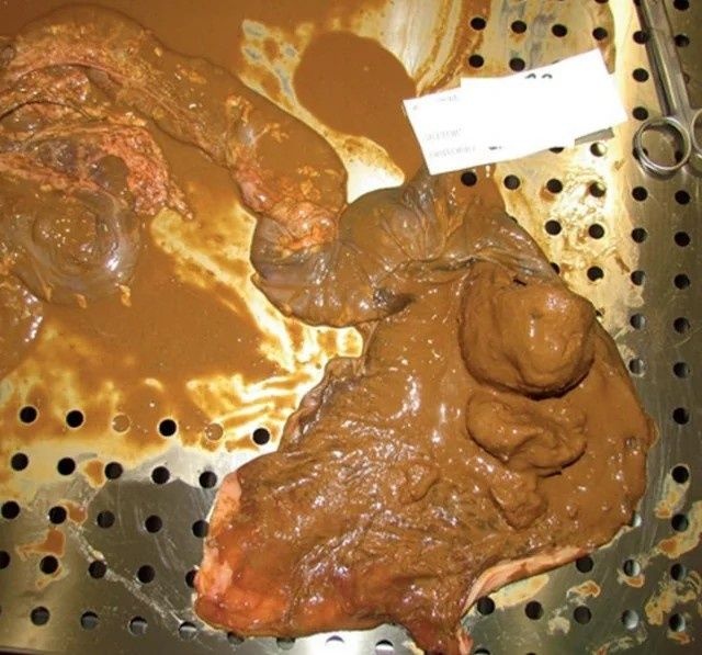 レス2番の画像3