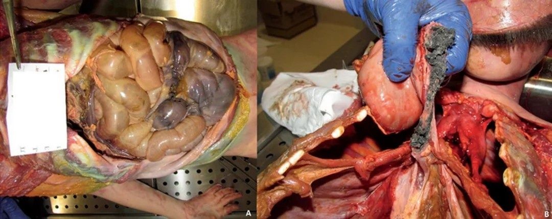 レス2番の画像2