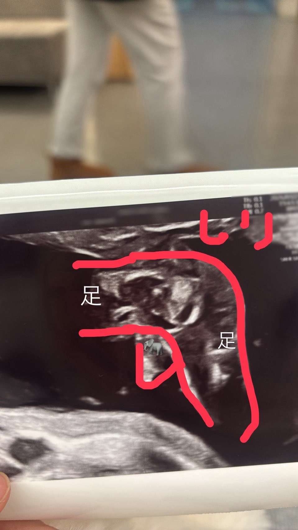 レス1番の画像4